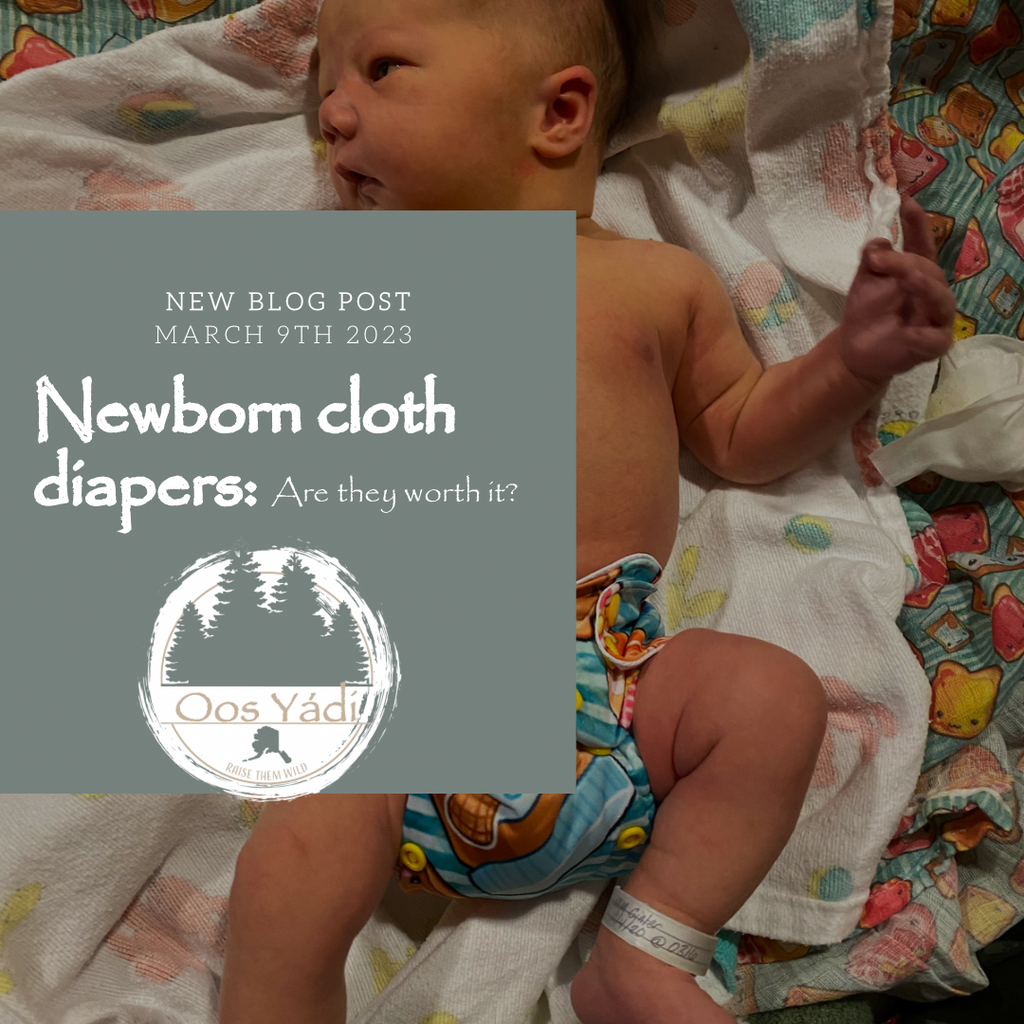 Newborn cloth diapers: Are they worth it?
